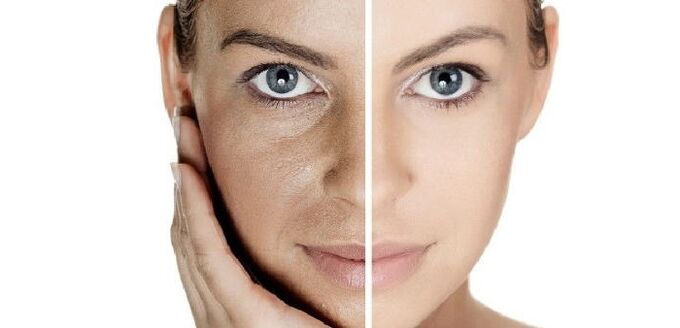 prije i poslije podmlađivanja kože lica