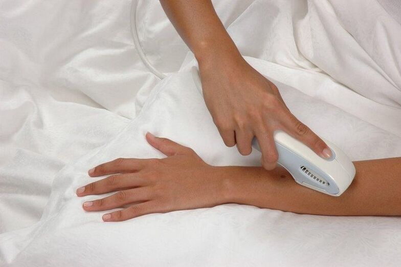 fotopodmlađivanje kože ruku