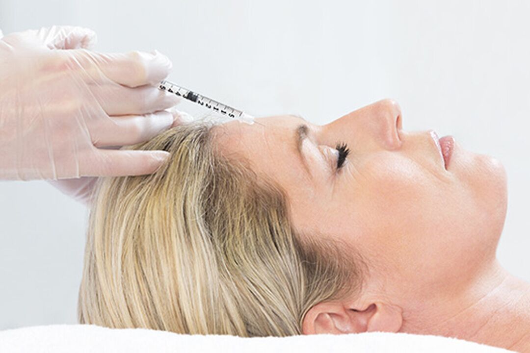 Plazmolifting je injekcijska metoda podmlađivanja kože lica